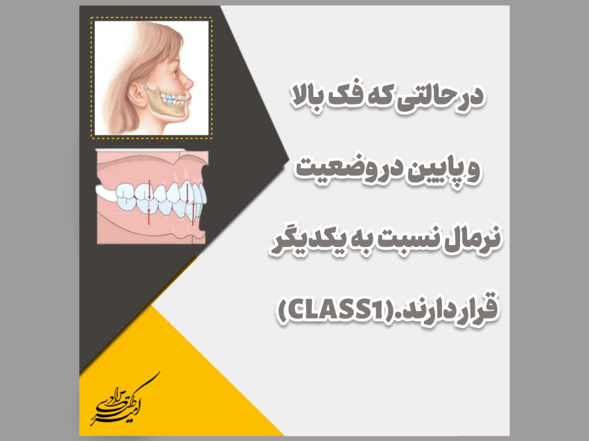 انواع روابط فکی