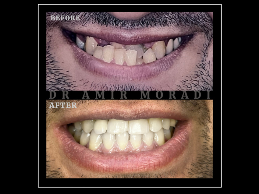 بیمار شماره ۹