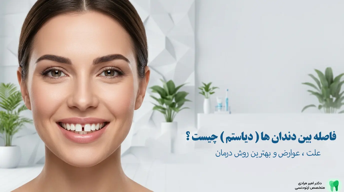 فاصله بین دندان‌ها (دیاستم) چیست؟ | علت، عوارض و بهترین روش درمان