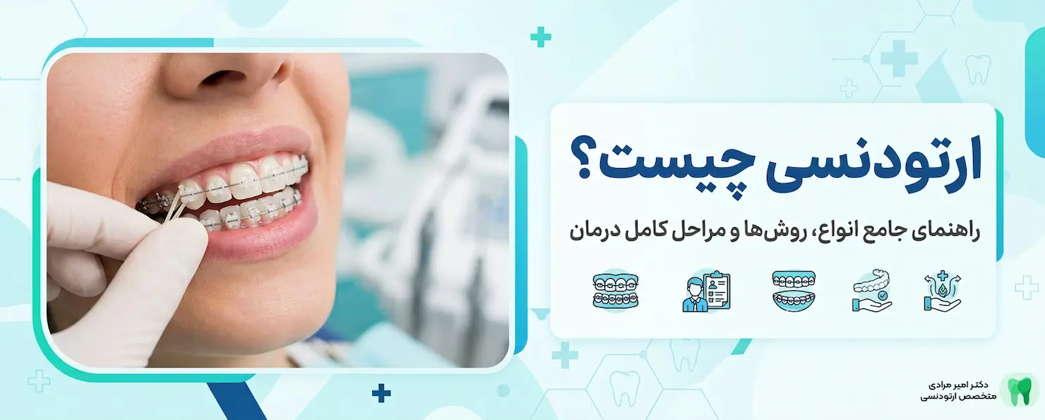 ارتودنسی چیست؟ راهنمای جامع انواع و روش‌های درمان